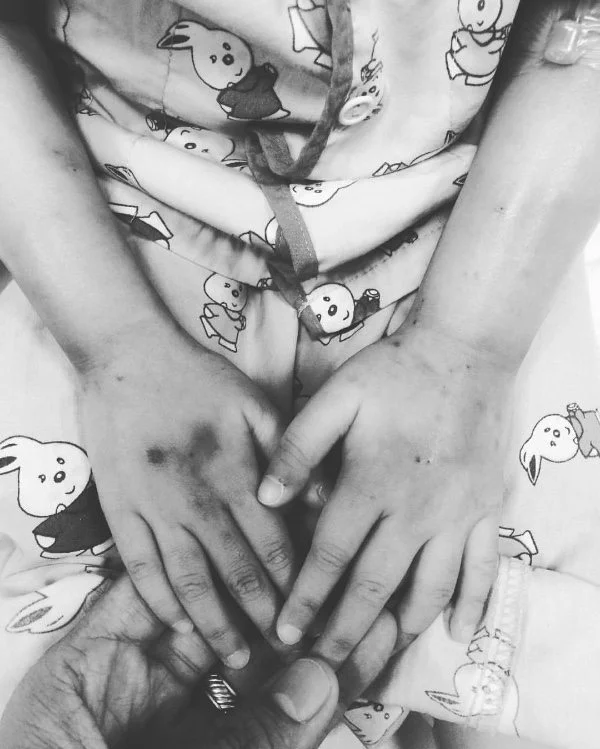 swollen hands of catie lucas